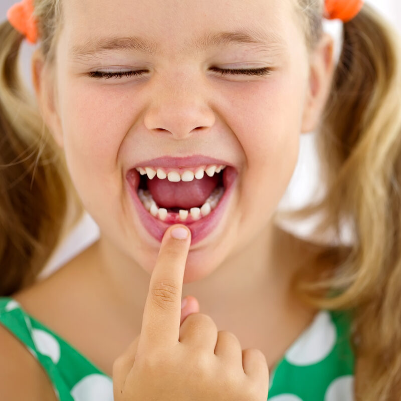 Child pointing at a missing or broken tooth while smiling