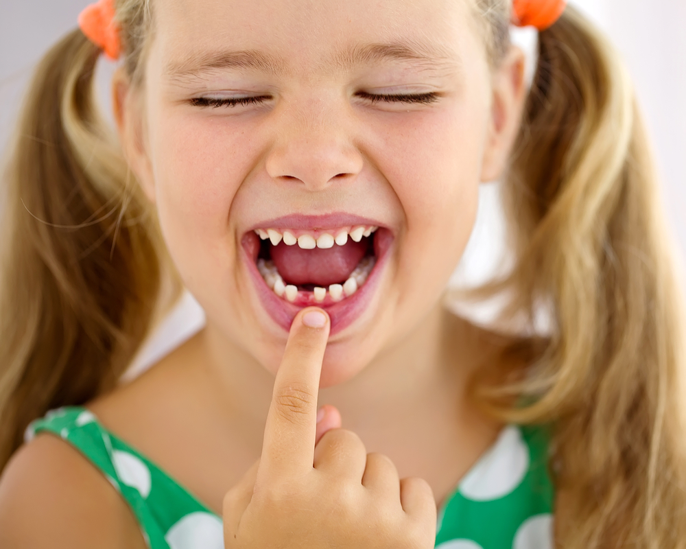 What To Do If Your Child Breaks a Tooth on Thanksgiving
